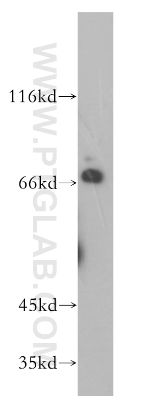 WB analysis of HeLa using 17532-1-AP