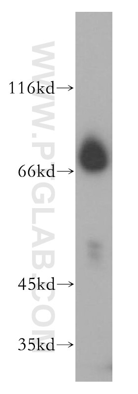 Western Blot (WB) analysis of MCF-7 cells using CTDSPL2 Polyclonal antibody (17532-1-AP)