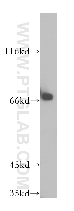 Western Blot (WB) analysis of mouse testis tissue using CTDSPL2 Polyclonal antibody (17532-1-AP)