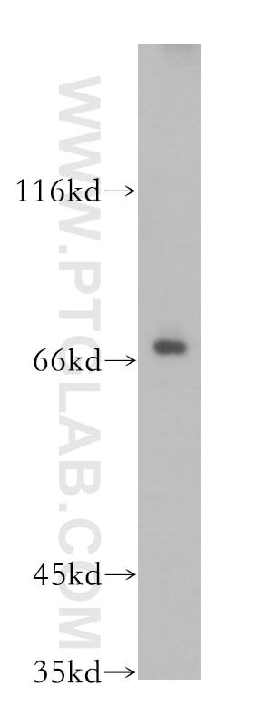 Western Blot (WB) analysis of mouse eye tissue using CTDSPL2 Polyclonal antibody (17532-1-AP)