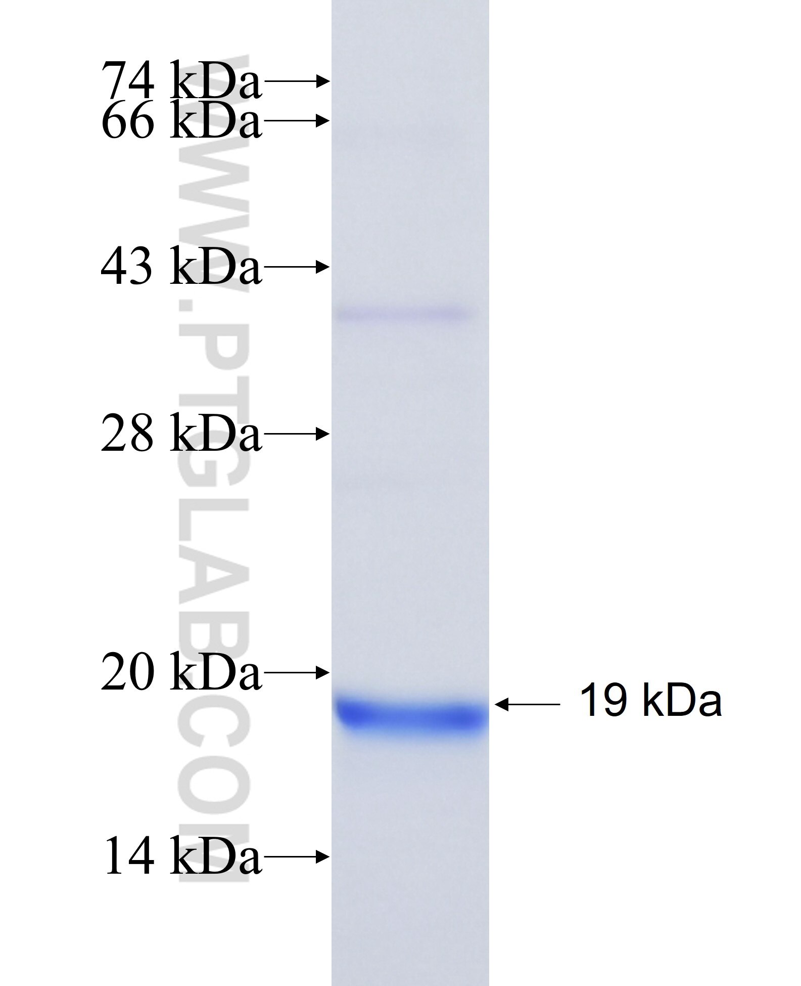 CTF1 fusion protein Ag39238 SDS-PAGE CTF1 fusion protein Ag39238 SDS-PAGE