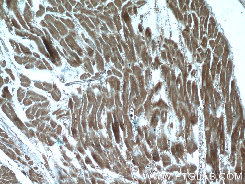 Immunohistochemistry (IHC) staining of human heart tissue using CTF1-Specific Polyclonal antibody (17518-1-AP)