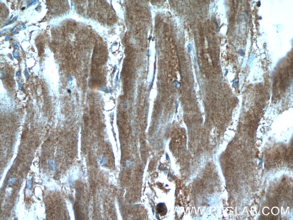 Immunohistochemistry (IHC) staining of human heart tissue using CTF1-Specific Polyclonal antibody (17518-1-AP)