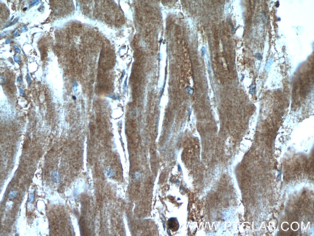 IHC staining of human heart using 17518-1-AP