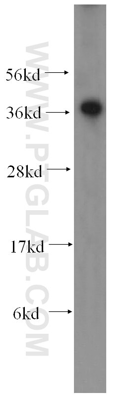 Western Blot (WB) analysis of PC-3 cells using CTF1-Specific Polyclonal antibody (17518-1-AP)