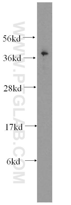 Western Blot (WB) analysis of HepG2 cells using CTF1-Specific Polyclonal antibody (17518-1-AP)