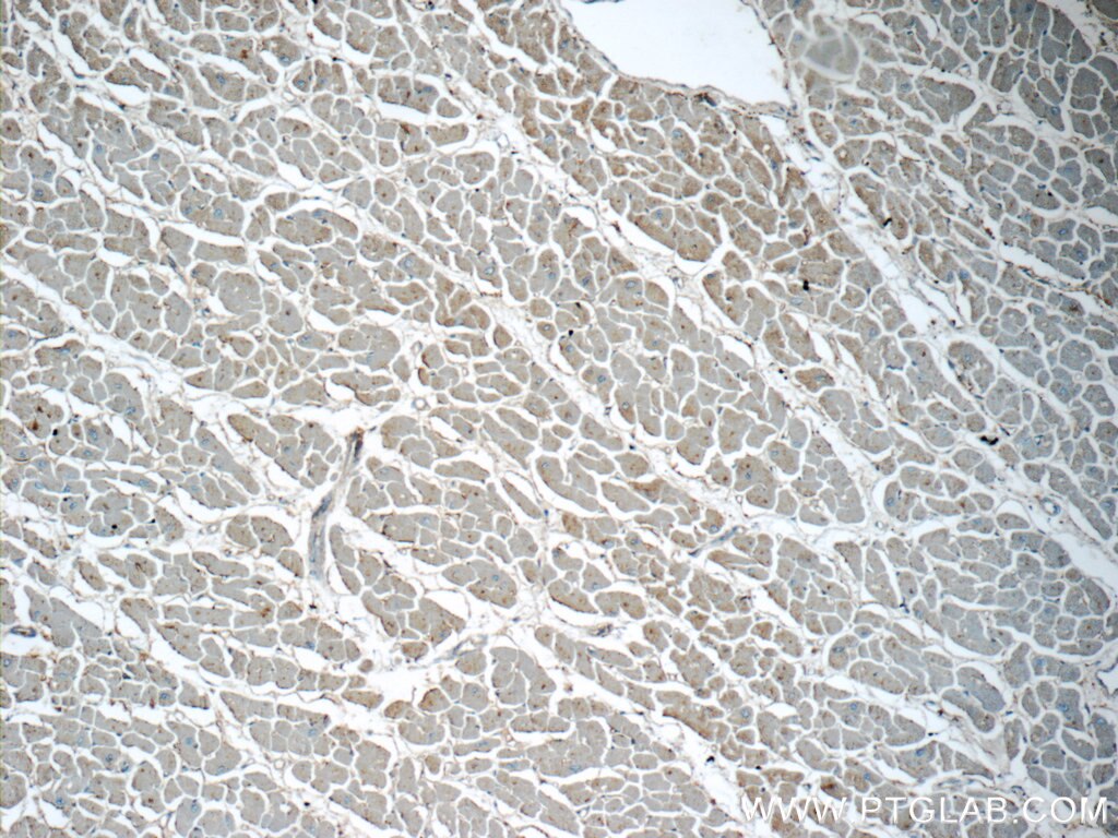 Immunohistochemistry (IHC) staining of human heart tissue using CTGF Polyclonal antibody (23903-1-AP)