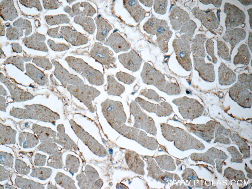 Immunohistochemistry (IHC) staining of human heart tissue using CTGF Polyclonal antibody (23903-1-AP)