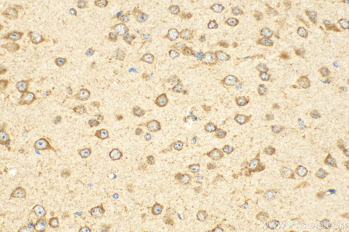 Immunohistochemistry (IHC) staining of mouse brain tissue using CTGF Polyclonal antibody (23903-1-AP)