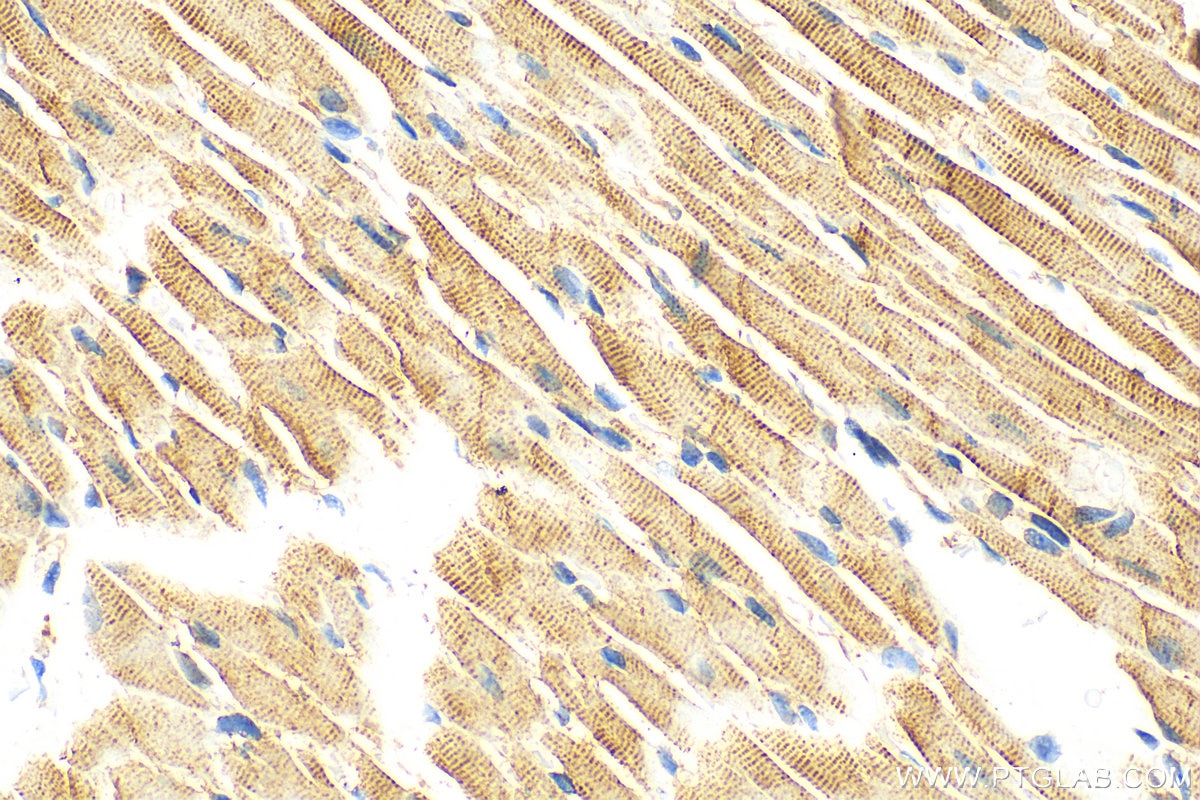 Immunohistochemistry (IHC) staining of mouse heart tissue using CTGF Polyclonal antibody (23903-1-AP)