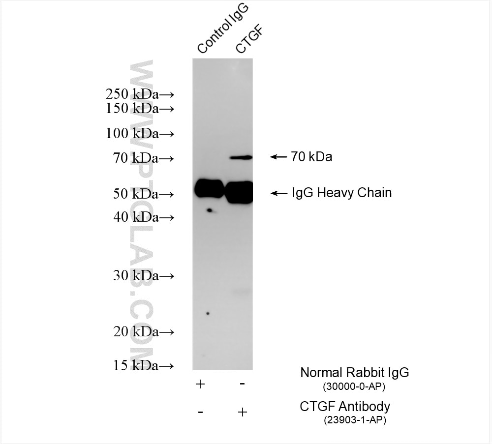 Immunoprecipitation (IP) experiment of mouse brain tissue using CTGF Polyclonal antibody (23903-1-AP)