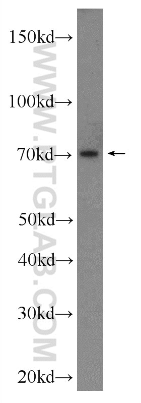 Western Blot (WB) analysis of mouse brain tissue using CTGF Polyclonal antibody (23903-1-AP)