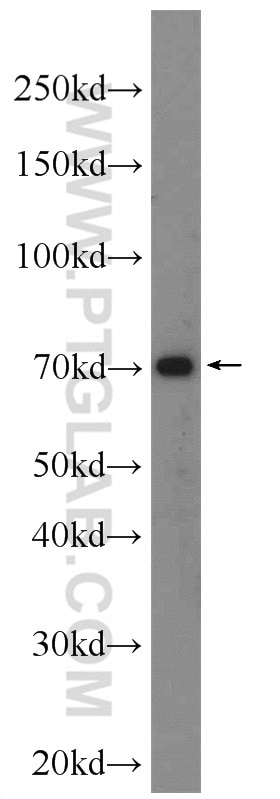 Western Blot (WB) analysis of mouse heart tissue using CTGF Polyclonal antibody (23903-1-AP)