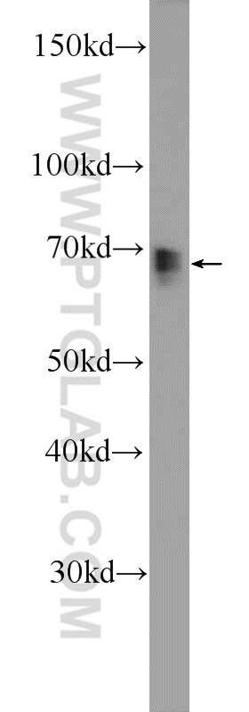 Western Blot (WB) analysis of mouse kidney tissue using CTGF Polyclonal antibody (23903-1-AP)