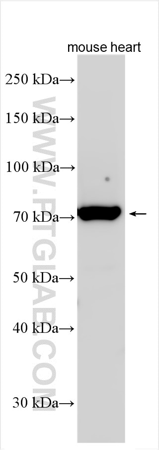 Western Blot (WB) analysis of various lysates using CTGF Polyclonal antibody (23903-1-AP)