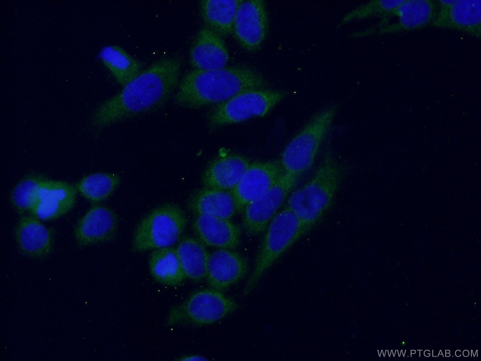 Immunofluorescence (IF) / fluorescent staining of HeLa cells using CTGF Polyclonal antibody (23936-1-AP)