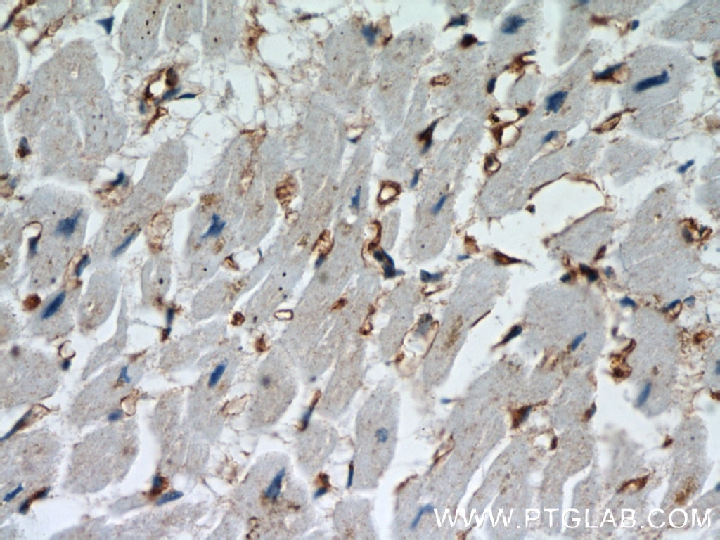 CTGF Polyclonal antibody