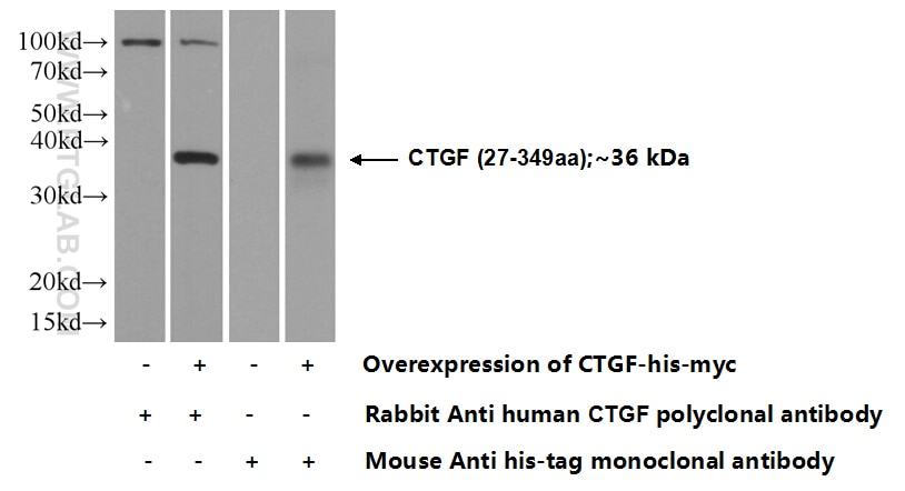 CTGF Polyclonal antibody
