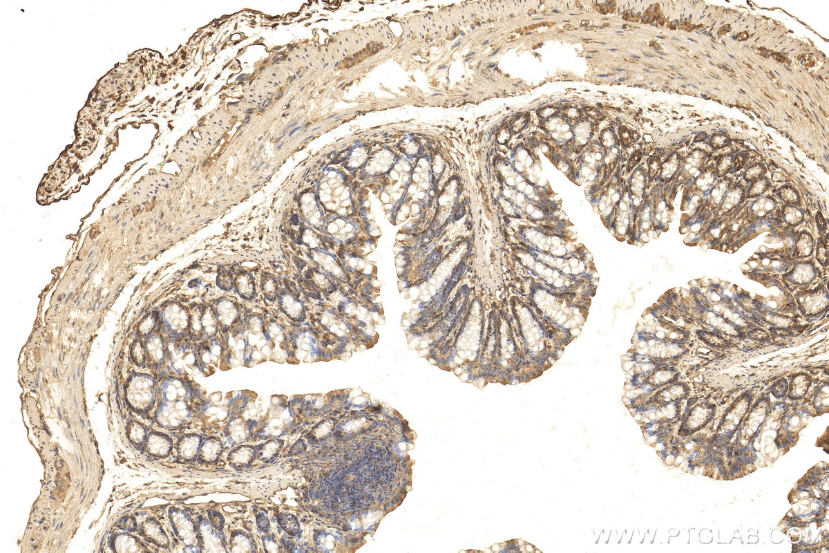 Immunohistochemistry (IHC) staining of mouse colon tissue using CTGF Polyclonal antibody (25474-1-AP)