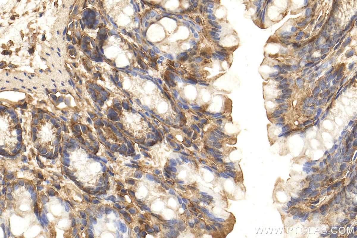 Immunohistochemistry (IHC) staining of mouse colon tissue using CTGF Polyclonal antibody (25474-1-AP)
