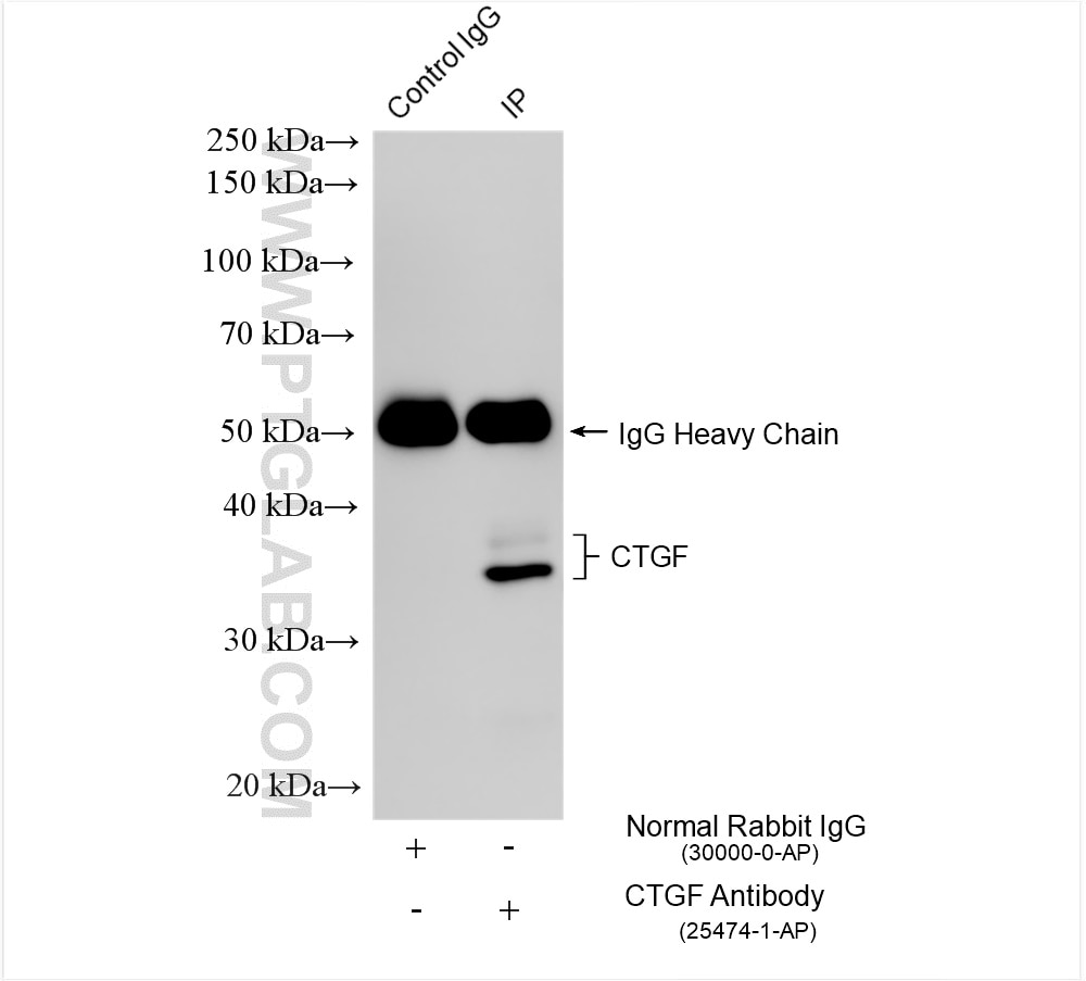 Immunoprecipitation (IP) experiment of HUVEC cells using CTGF Polyclonal antibody (25474-1-AP)