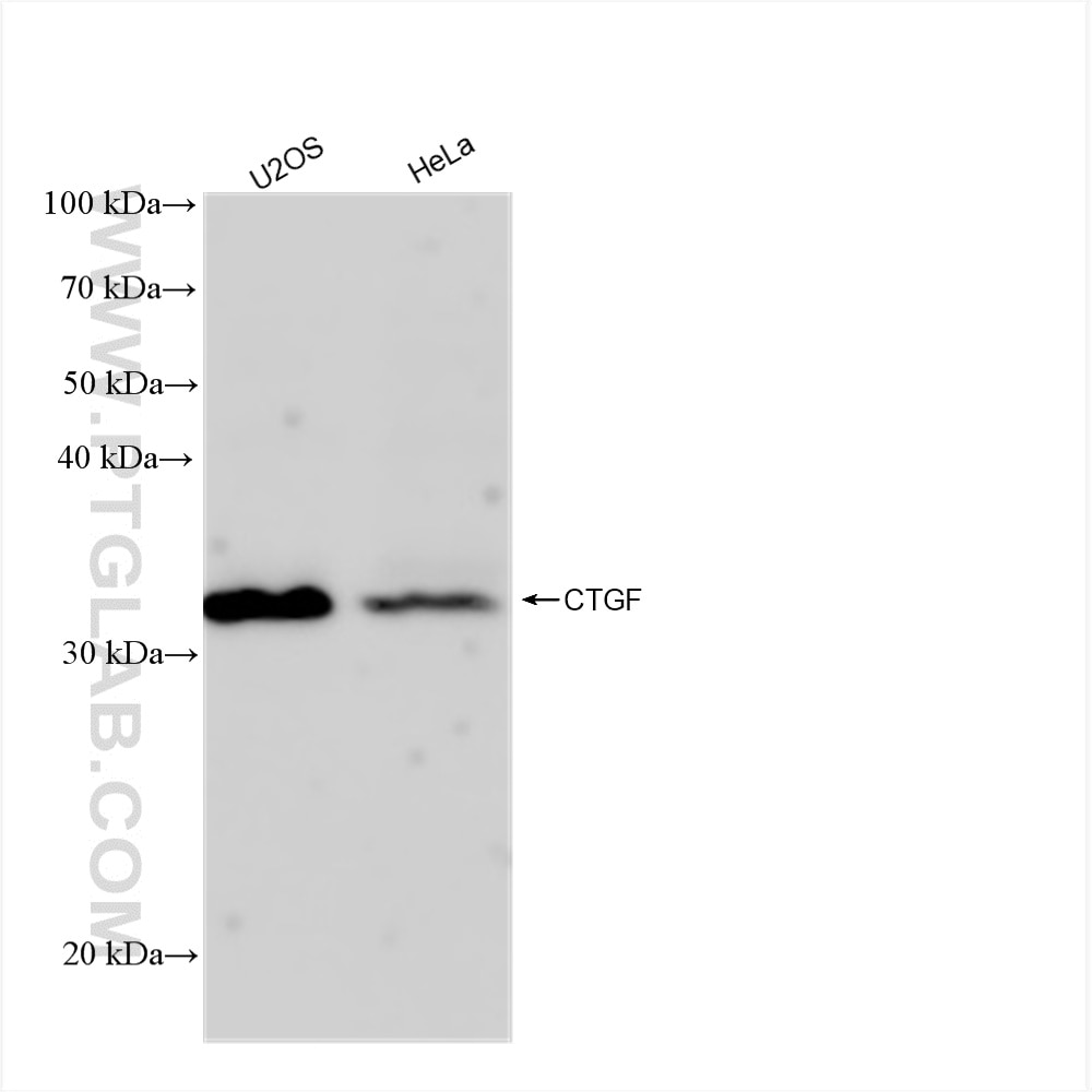 Western Blot (WB) analysis of various lysates using CTGF Recombinant antibody (82976-1-RR)