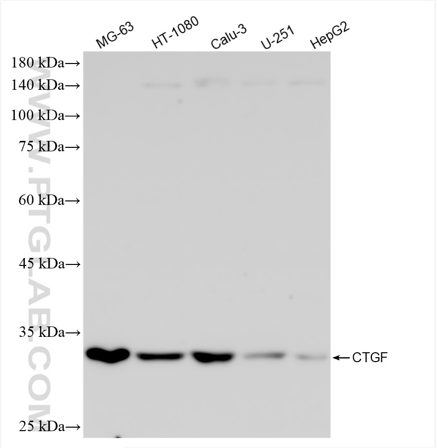 Western Blot (WB) analysis of various lysates using CTGF Recombinant antibody (82976-1-RR)