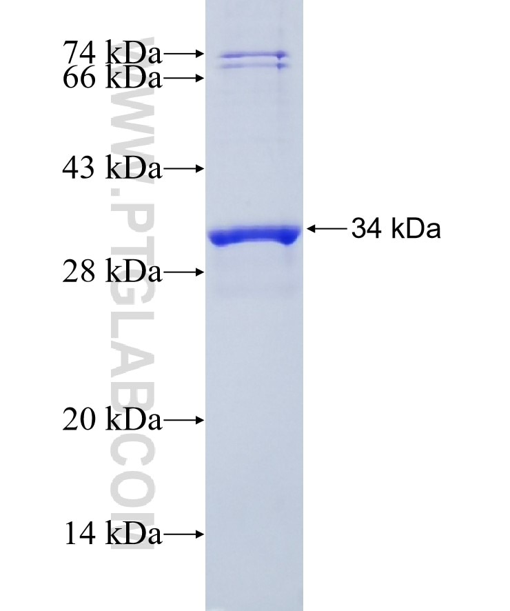 CTGF fusion protein Ag20985 SDS-PAGE
