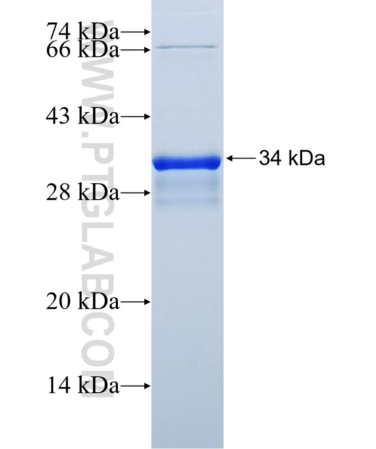 CTGF fusion protein Ag20985 SDS-PAGE