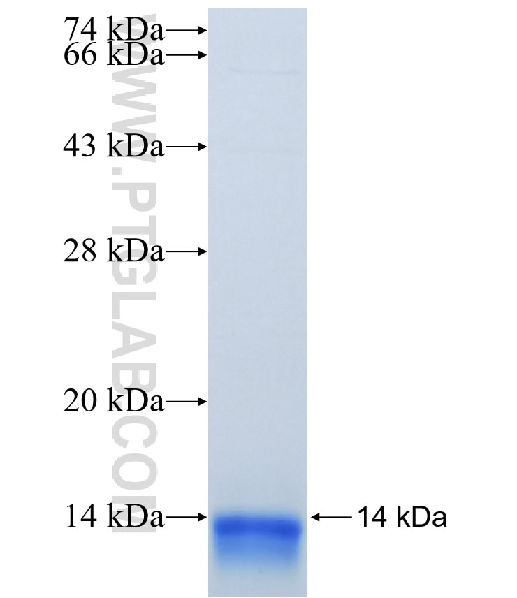 CTGF fusion protein Ag21008 SDS-PAGE