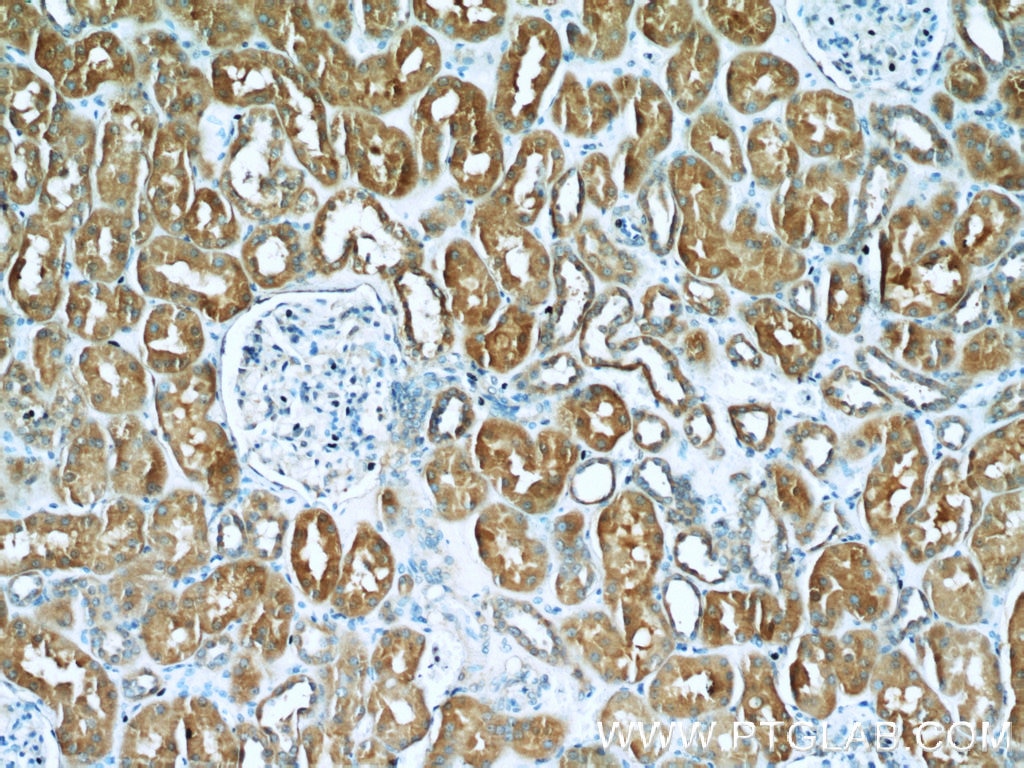 Immunohistochemistry (IHC) staining of human kidney tissue using Gamma Cystathionase Polyclonal antibody (12217-1-AP)