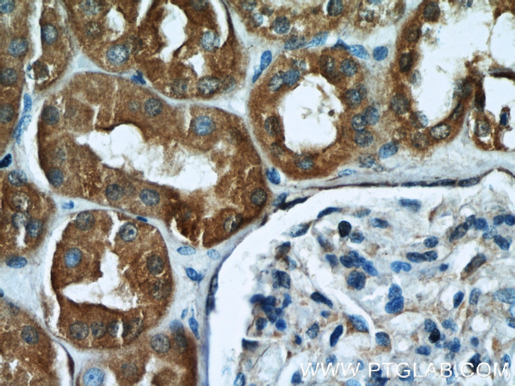 Immunohistochemistry (IHC) staining of human kidney tissue using Gamma Cystathionase Polyclonal antibody (12217-1-AP)