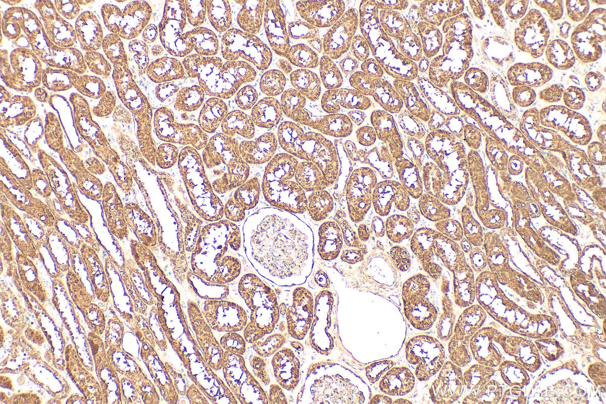 Immunohistochemistry (IHC) staining of human kidney tissue using Gamma Cystathionase Polyclonal antibody (12217-1-AP)
