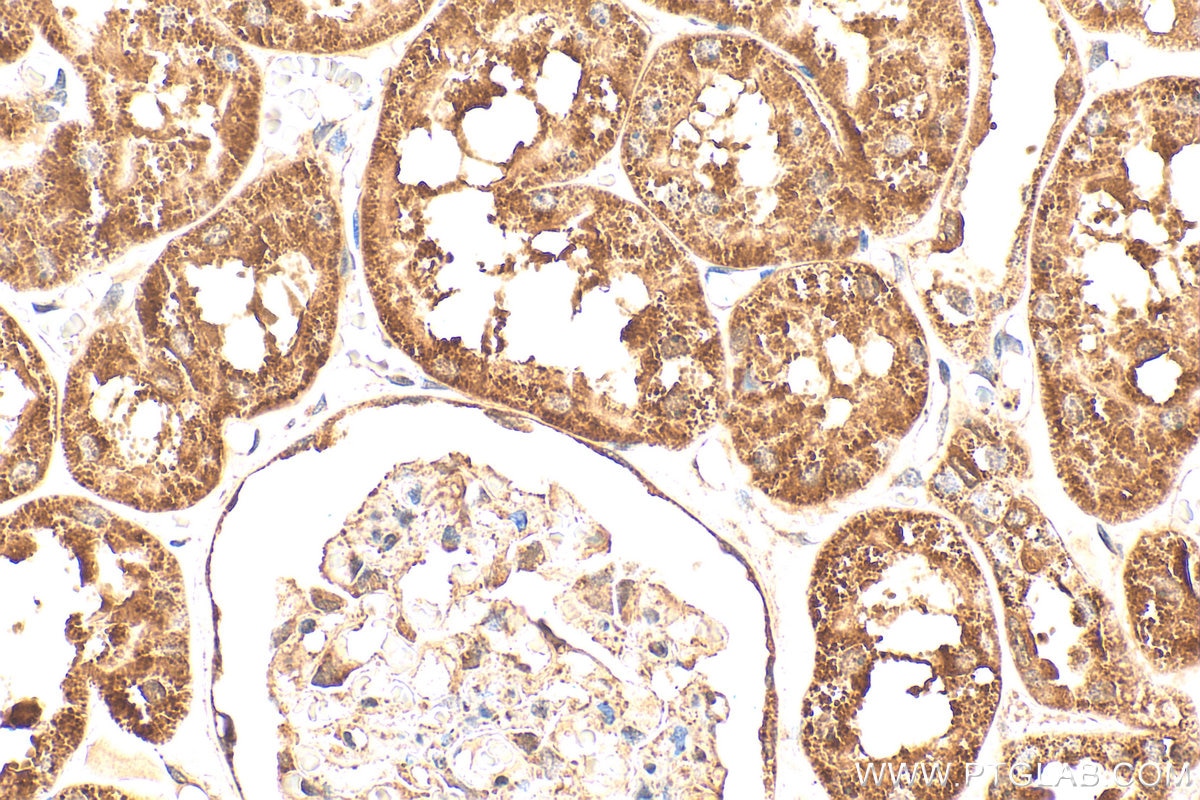 Immunohistochemistry (IHC) staining of human kidney tissue using Gamma Cystathionase Polyclonal antibody (12217-1-AP)