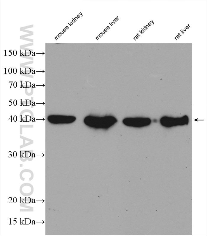 Western Blot (WB) analysis of various lysates using Gamma Cystathionase Polyclonal antibody (12217-1-AP)