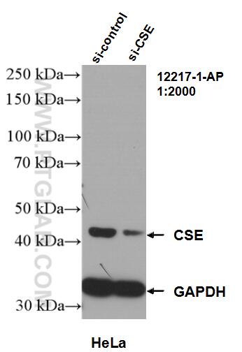 Western Blot (WB) analysis of HeLa cells using Gamma Cystathionase Polyclonal antibody (12217-1-AP)