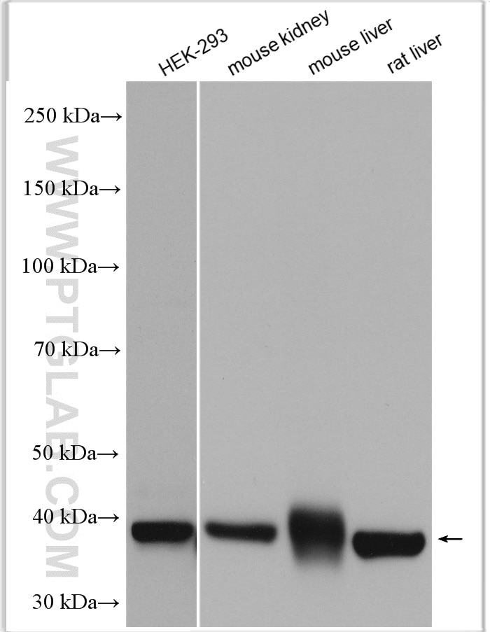 Western Blot (WB) analysis of various lysates using Gamma Cystathionase Polyclonal antibody (12217-1-AP)