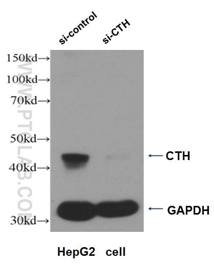 Western Blot (WB) analysis of HepG2 cells using Gamma Cystathionase Polyclonal antibody (12217-1-AP)
