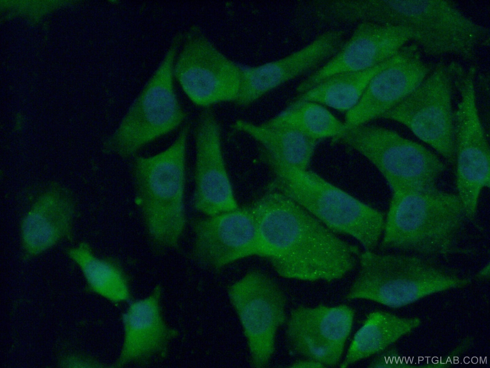 Immunofluorescence (IF) / fluorescent staining of A375 cells using CTHRC1 Polyclonal antibody (16534-1-AP)