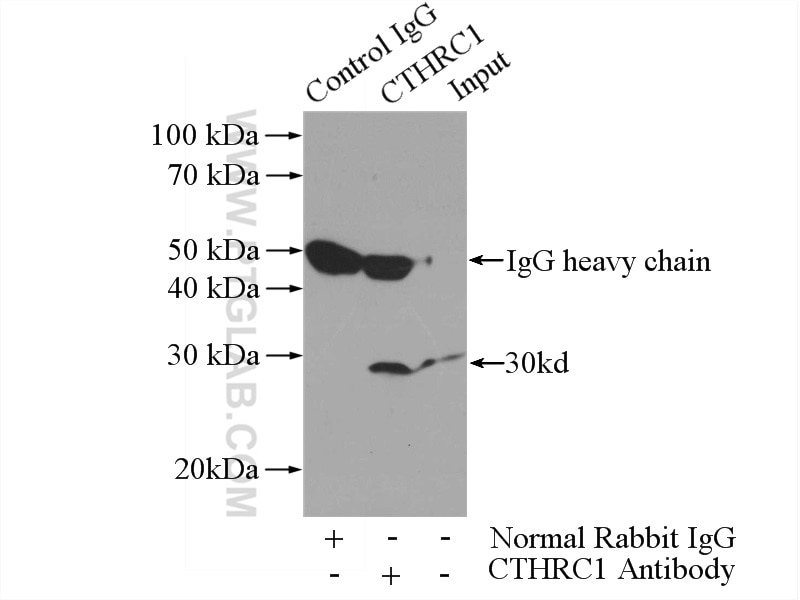 Immunoprecipitation (IP) experiment of A375 cells using CTHRC1 Polyclonal antibody (16534-1-AP)