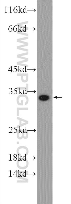 Western Blot (WB) analysis of rat lung tissue using CTHRC1 Polyclonal antibody (16534-1-AP)