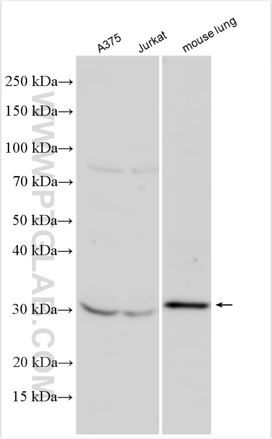 Western Blot (WB) analysis of various lysates using CTHRC1 Polyclonal antibody (16534-1-AP)