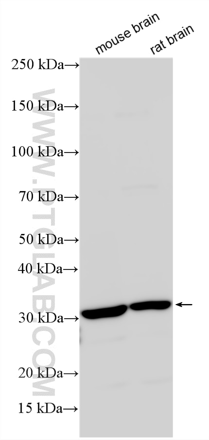 Western Blot (WB) analysis of various lysates using CTHRC1 Polyclonal antibody (16534-1-AP)