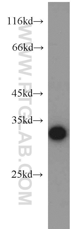 Western Blot (WB) analysis of A375 cells using CTHRC1 Polyclonal antibody (16534-1-AP)