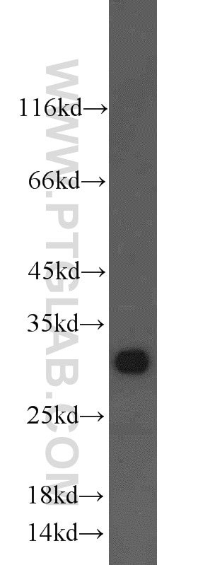 Western Blot (WB) analysis of mouse lung tissue using CTHRC1 Polyclonal antibody (16534-1-AP)