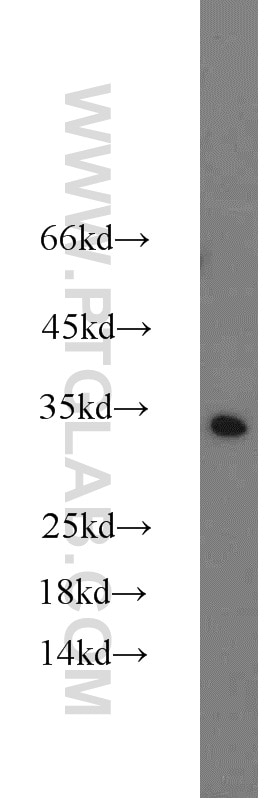 Western Blot (WB) analysis of HEK-293 cells using CTHRC1 Polyclonal antibody (16534-1-AP)