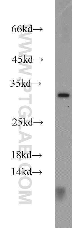 Western Blot (WB) analysis of Jurkat cells using CTHRC1 Polyclonal antibody (16534-1-AP)