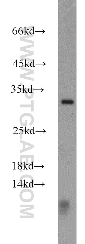 WB analysis of Jurkat using 16534-1-AP