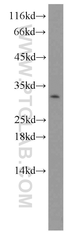 Western Blot (WB) analysis of mouse brain tissue using CTHRC1 Polyclonal antibody (16534-1-AP)