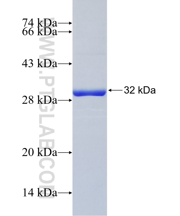 CTHRC1 fusion protein Ag9812 SDS-PAGE